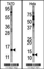 Anti-FAU Rabbit Polyclonal Antibody (AP (Alkaline Phosphatase))