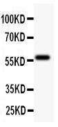 Anti-TdT Polyclonal Antibody