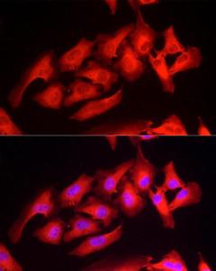 Immunofluorescence analysis of HeLa cells using Anti-Peroxiredoxin 2/PRP Antibody (A307012) at a dilution of 1:50 (40X lens). DAPI was used to stain the cell nuclei (blue)