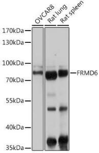 Western blot analysis of extracts of various cell lines, using Anti-FRMD6/Willin Antibody (A12445) at 1:1,000 dilution The secondary antibody was Goat Anti-Rabbit IgG H&L Antibody (HRP) at 1:10,000 dilution Lysates/proteins were present at 25 µg per lane