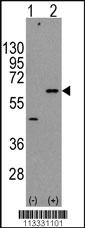 Anti-AKT3 Rabbit Polyclonal Antibody