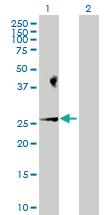 Anti-BAD Rabbit Polyclonal Antibody