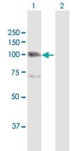 Anti-ITGB6 Rabbit Polyclonal Antibody