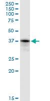 Anti-PRPF18 Mouse Polyclonal Antibody