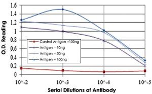 Anti-BMPR2 Mouse Monoclonal Antibody [clone: 1F12]