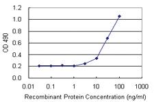 Anti-TRAF6 Polyclonal Antibody Pair