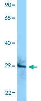 Anti-CD151 Rabbit Polyclonal Antibody