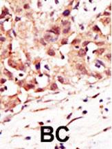 Anti-SENP5 Rabbit Polyclonal Antibody