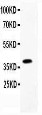 Anti-B Raf Polyclonal Antibody