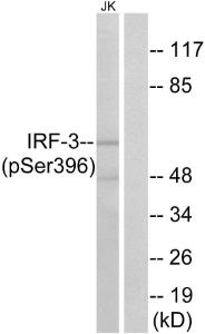 Western blot analysis of lysates from Jurkat cells treated with EGF 200ng/ml 30' using Anti-IRF-3 (phospho Ser396) Antibody. The right hand lane represents a negative control, where the antibody is blocked by the immunising peptide