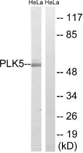 Western blot analysis of lysates from HeLa cells using Anti-PLK5 Antibody. The right hand lane represents a negative control, where the Antibody is blocked by the immunising peptide