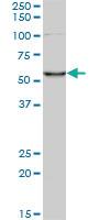 Anti-CORO1C Mouse Monoclonal Antibody [clone: 1F7]