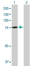 Anti-AHI1 Rabbit Polyclonal Antibody