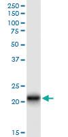 Anti-CLDN14 Polyclonal Antibody Pair