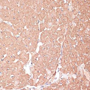 Immunohistochemistry analysis of paraffin-embedded rat heart using Anti-FRMD6/Willin Antibody (A12445) at a dilution of 1:100 (40x lens) Perform microwave antigen retrieval with 10 mM PBS buffer pH 72 before commencing with IHC staining protocol