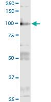 Anti-ITGB6 Rabbit Polyclonal Antibody