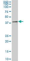 Anti-PRPF18 Mouse Polyclonal Antibody