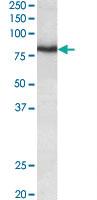 Anti-KCNC3 Goat Polyclonal Antibody