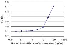 Anti-SEPX1 Antibody Pair