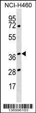 Anti-HNRNPH3 Rabbit Polyclonal Antibody (Biotin)