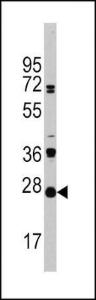 Anti-CD3G Rabbit Polyclonal Antibody (AP (Alkaline Phosphatase))