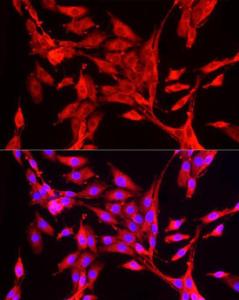 Immunofluorescence analysis of PC-12 cells using Anti-Peroxiredoxin 2/PRP Antibody (A307012) at a dilution of 1:50 (40X lens). DAPI was used to stain the cell nuclei (blue)