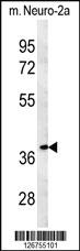 Anti-TNFAIP1 Rabbit Polyclonal Antibody