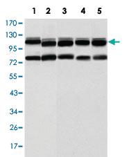 Anti-BMPR2 Mouse Monoclonal Antibody [clone: 1F12]