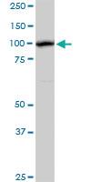 Anti-AHI1 Rabbit Polyclonal Antibody