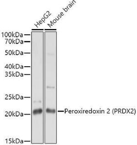 Western blot analysis of extracts of various cell lines, using Anti-Peroxiredoxin 2/PRP Antibody (A307013) at 1:1,000 dilution The secondary antibody was Goat Anti-Rabbit IgG H&L Antibody (HRP) at 1:10,000 dilution Lysates/proteins were present at 25 µg per lane