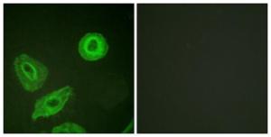 Immunofluorescence analysis of HeLa cells using Anti-HER3 (phospho Tyr1289) Antibody. The right hand panel represents a negative control, where the antibody was pre-incubated with the immunising peptide