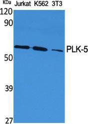 Western blot analysis of various cells using Anti-PLK5 Antibody