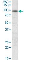 Anti-UNC45B Goat Polyclonal Antibody