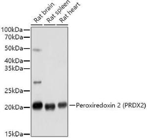 Western blot analysis of extracts of various cell lines, using Anti-Peroxiredoxin 2/PRP Antibody (A307013) at 1:1,000 dilution The secondary antibody was Goat Anti-Rabbit IgG H&L Antibody (HRP) at 1:10,000 dilution Lysates/proteins were present at 25 µg per lane