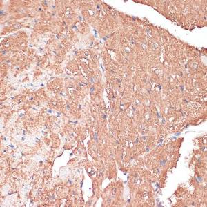 Immunohistochemistry analysis of paraffin-embedded mouse heart using Anti-FRMD6/Willin Antibody (A12445) at a dilution of 1:100 (40x lens) Perform microwave antigen retrieval with 10 mM PBS buffer pH 72 before commencing with IHC staining protocol