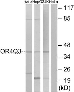 Western blot analysis of lysates from HeLa, Jurkat, and HepG2 cells using Anti-OR4Q3 Antibody. The right hand lane represents a negative control, where the antibody is blocked by the immunising peptide.