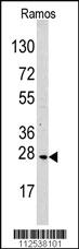 Anti-MOB1B Rabbit Polyclonal Antibody