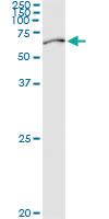 Anti-PABPC3 Polyclonal Antibody Pair