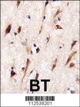 Anti-MOB1B Rabbit Polyclonal Antibody