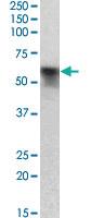 Anti-SERPINA6 Goat Polyclonal Antibody