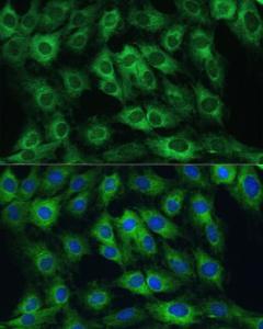 Immunofluorescence analysis of C6 cells using Anti-FRMD6/Willin Antibody (A12445) at a dilution of 1:100 DAPI was used to stain the cell nuclei (blue)