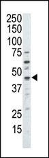 Anti-DAPK2 Rabbit Polyclonal Antibody