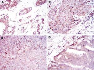 Anti-BMPR2 Mouse Monoclonal Antibody [clone: 1F12]