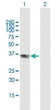 Anti-GIPC2 Mouse Polyclonal Antibody