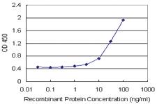 Anti-SEPX1 Polyclonal Antibody Pair