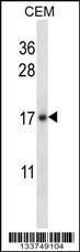 Anti-IL21 Rabbit Polyclonal Antibody