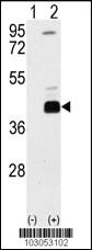 Anti-DAPK2 Rabbit Polyclonal Antibody