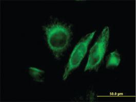 Anti-SPRY2 Mouse Monoclonal Antibody [clone: 1E10]