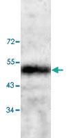 Anti-CNN3 Rabbit Polyclonal Antibody