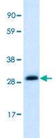 Anti-ABT1 Rabbit Polyclonal Antibody